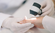 Private Dermatology Clinic in Slough- Call 02036330332