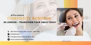Affordable Composite Bonding in London – Transform Your Smile Today