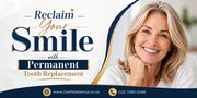 Reclaim Your Smile with Permanent Tooth Replacement
