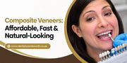 Composite Veneers: Affordable, Fast & Natural-Looking